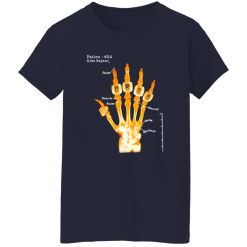 Kobe Bryant Skeleton Hand Shirt, Patien 24 Kobe Bryant Shirt